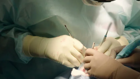 Two professional doctors perform dental surgery Stock Footage 236054994