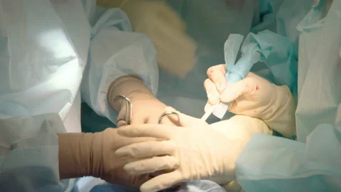 Two professional doctors perform dental surgery Stock Footage 236056633