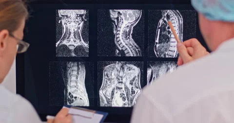 Two radiologist doctors examine an X-ray of a patient's spine  Stock Footage 160038289
