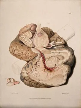 Two sections of diseased brain. Coloured aquatint by W. Say after F. R. Say.. Stock Illustration