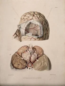 Two sections of diseased brain. Coloured aquatint by W. Say after F. R. Say.. Stock Illustration