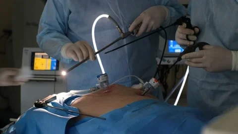 Two surgeons in lab coats and an assistant perform endoscopic surgery Stock Footage 132734103
