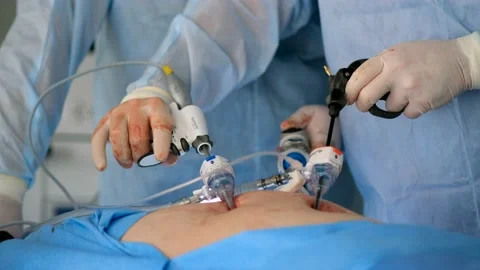 Two surgeons in lab coats and an assistant perform endoscopic surgery Stock Footage 132765900