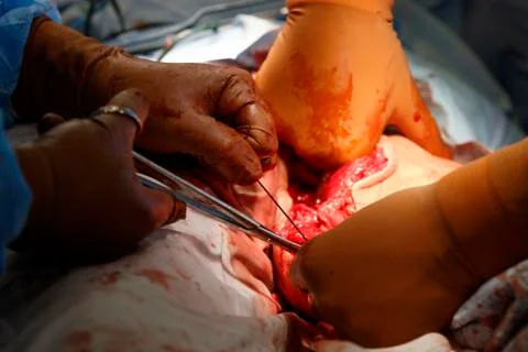 Two surgeons sutured close-up Photos