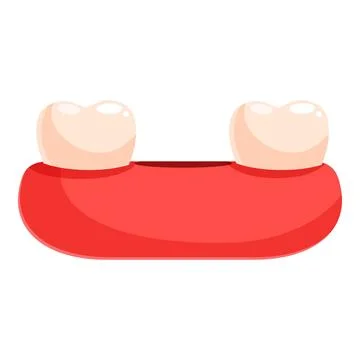 Two teeth attached to red gums showing diastema dental problem Stock Illustration