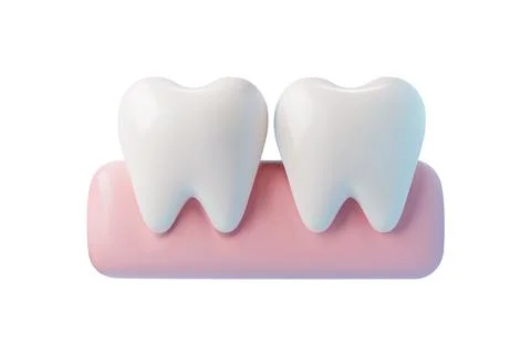Two teeth in the gum, 3d vector illustration, isolated on white. Stock Illustration