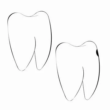 Two teeth Иллюстрация