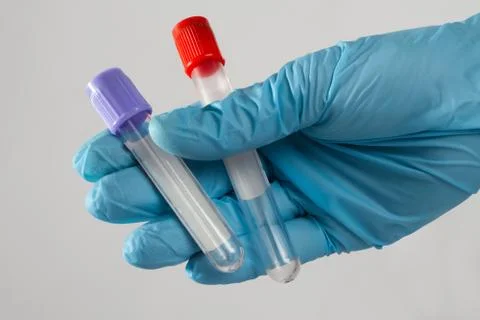 Two test tubes for blood analysis are in the hands of a medical worker Stock Photos