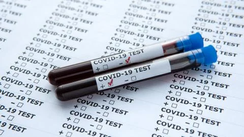 Two test tubes with blood sample for COVID-19, isolated on white paper Stock Photos
