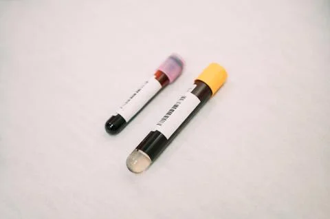 Two tubes with blood samples to be analysed for possible covid19 infected. Stock Photos