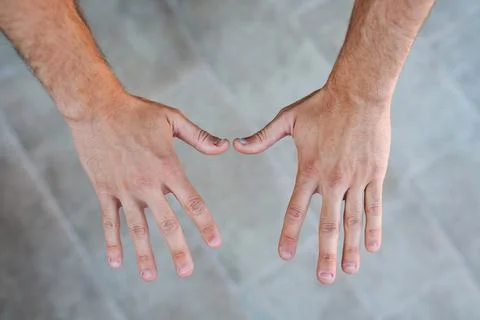 Two young man hands with ugly and bitten fingernails Stock-Fotos