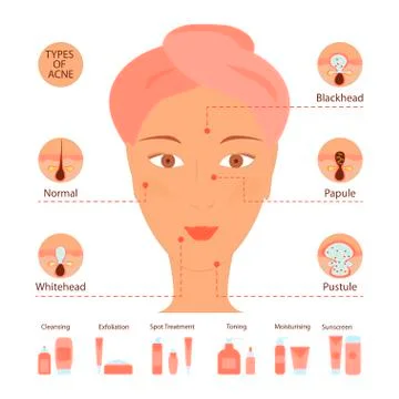 Types of acne pimples human skin poster Stock Illustration