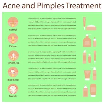 Types of acne pimples Stock Illustration