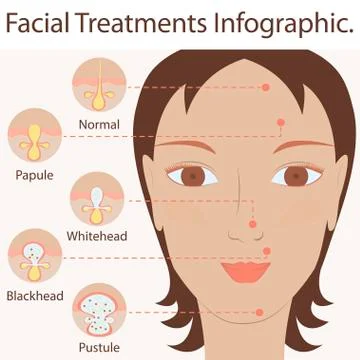 Types of acne pimples Stock Illustration