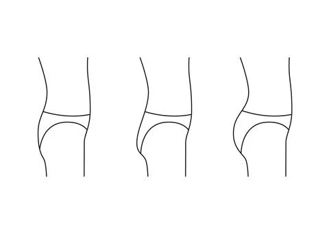 Types of butt woman, shape buttock side, line icon. Augmentation, reshape Stock Illustration