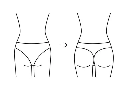 Types of butt woman, shape buttock back, line icon. Augmentation, reshape Stock Illustration
