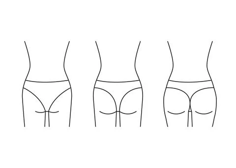Types of butt woman, shape buttock back, line icon. Augmentation, reshape Stock Illustration