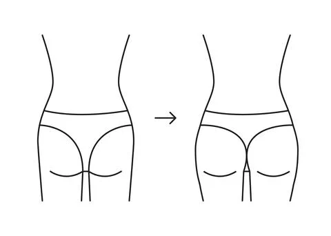 Types of butt woman, shape buttock back, line icon. Augmentation, reshape Stock Illustration