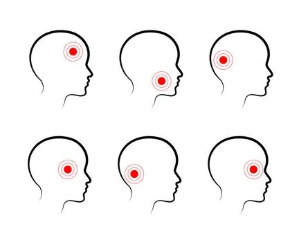 Types of headaches on a white background. Icon. Vector. Stock Illustration