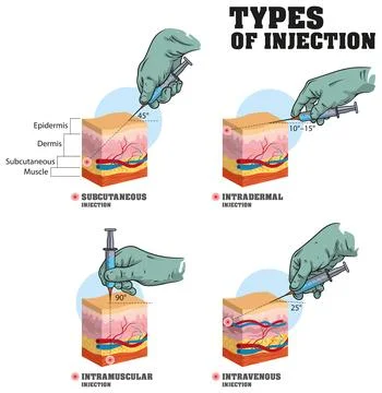 Types of injections Stock Illustration