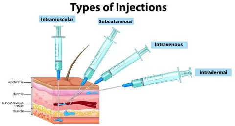 Types of Injections on White Background Stock Illustration