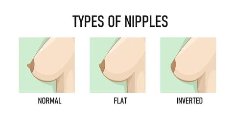 Types of Nipples. Vector illustration Stock Illustration