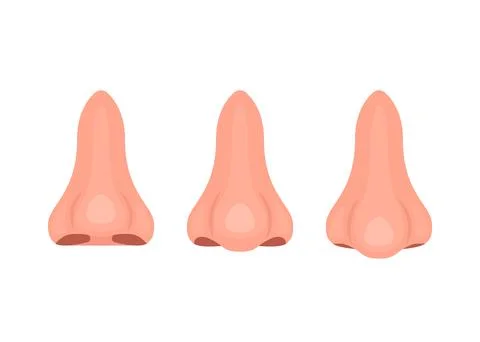 Types of noses, correction of nasal shape during rhinoplasty surgery. Snub-no Stock Illustration