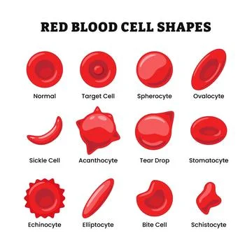 Types of Red Blood Cell Shapes or erythrocytes, morphology normal, target c.. Stock Illustration