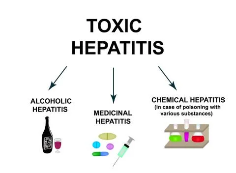 Types of Toxic hepatitis. Classification of Hepatitis A, B, C, D, E, F, G. Toxic Stock Illustration