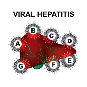 Types of viral hepatitis. Hepatitis A, B, C, D, E, F, G. World Hepatitis Day Stock Illustration