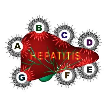 Types of viral hepatitis. Hepatitis A, B, C, D, E, F, G. World Hepatitis Day Stock Illustration