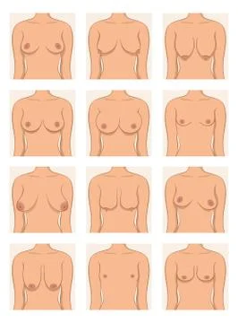 Types of women's breasts Stock Illustration