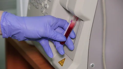 Typesetting of blood from the vials for analysis and marking of result Stock Footage 66341122