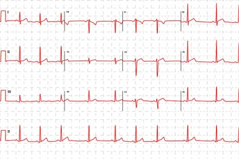 Typical human electrocardiogram, red graph with marks Stock Illustration
