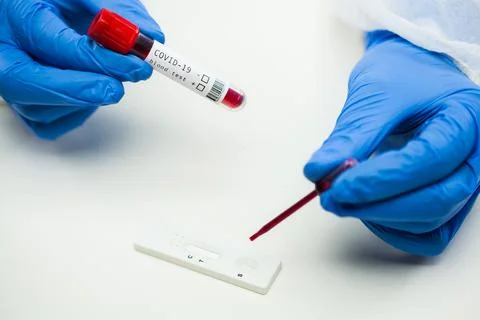 UK lab tech scientist placing blood sample on Rapid Diagnostic Test RDT casse Foto stock