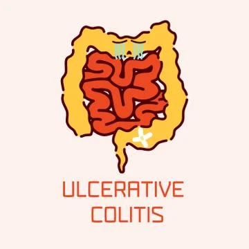 Ulcerative colitis poster Stock Illustration
