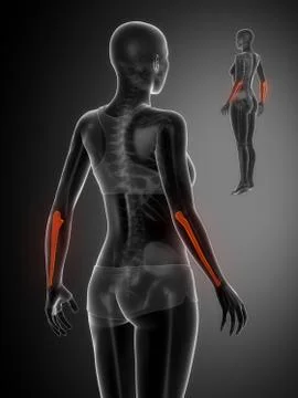ULNA black x--ray bone scan Stock Illustration