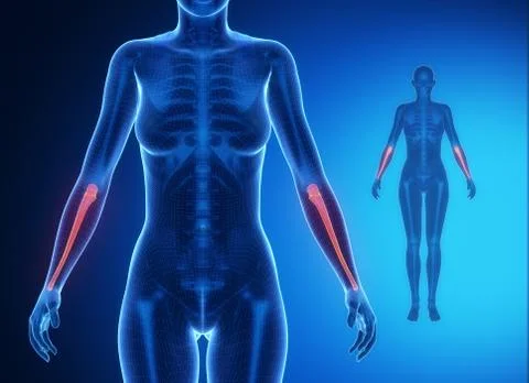 ULNA blue x--ray bone scan Stock Illustration