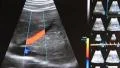 Ultrasonic examination HD Footage