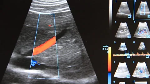 Ultrasonic examination Stock Footage 878718
