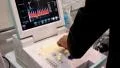 Ultrasonic scanner for medical examination HD Footage