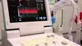 Ultrasonic scanner for medical examination HD Footage