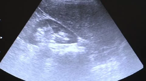 Ultrasonography 3 Stock Footage 11915769