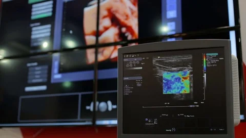 Ultrasonography of human organs Stock Footage 75667419