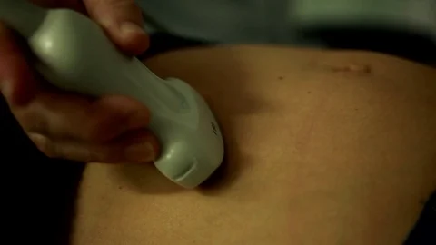 Ultrasound analysis Stock Footage 76474351