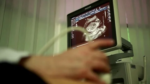 Ultrasound analysis Stock Footage 76474365