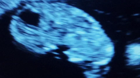 Ultrasound of Baby during Pregnancy, Visible heart beat Stock Footage