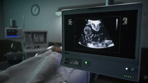 Ultrasound diagnostic analysis system checking the heartbeat of the unborn child Stock Footage 267172214