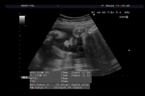 Ultrasound Stock Footage 30906040