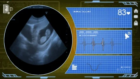 Ultrasound - Interface - medical screen - yellow Stock Footage